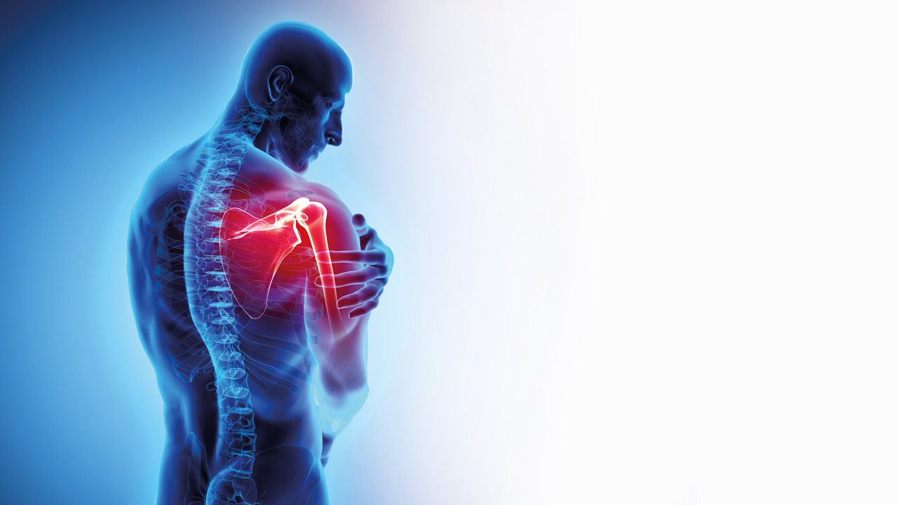 Musculoskeletal and joint pain Image