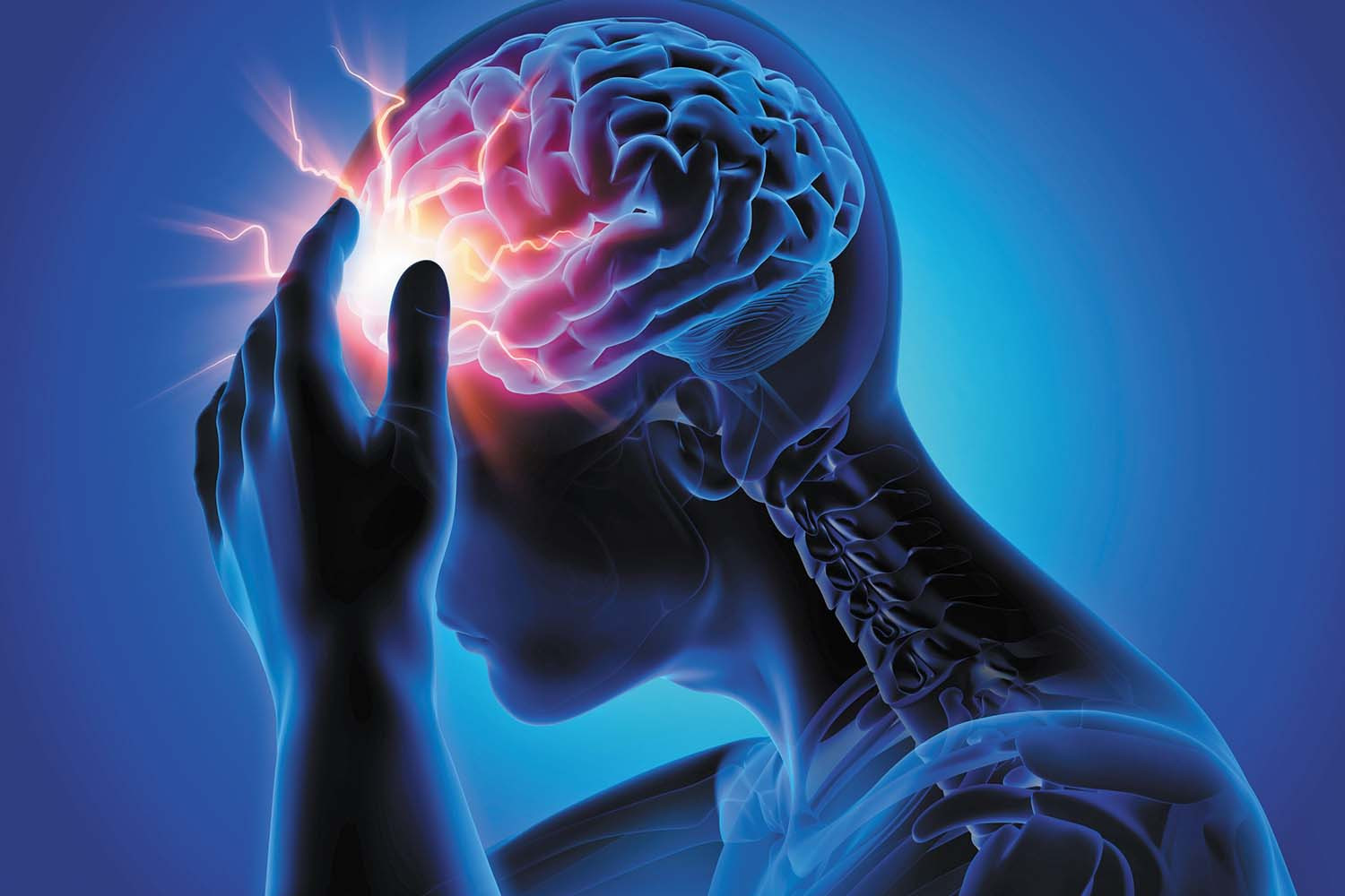 Headache Image