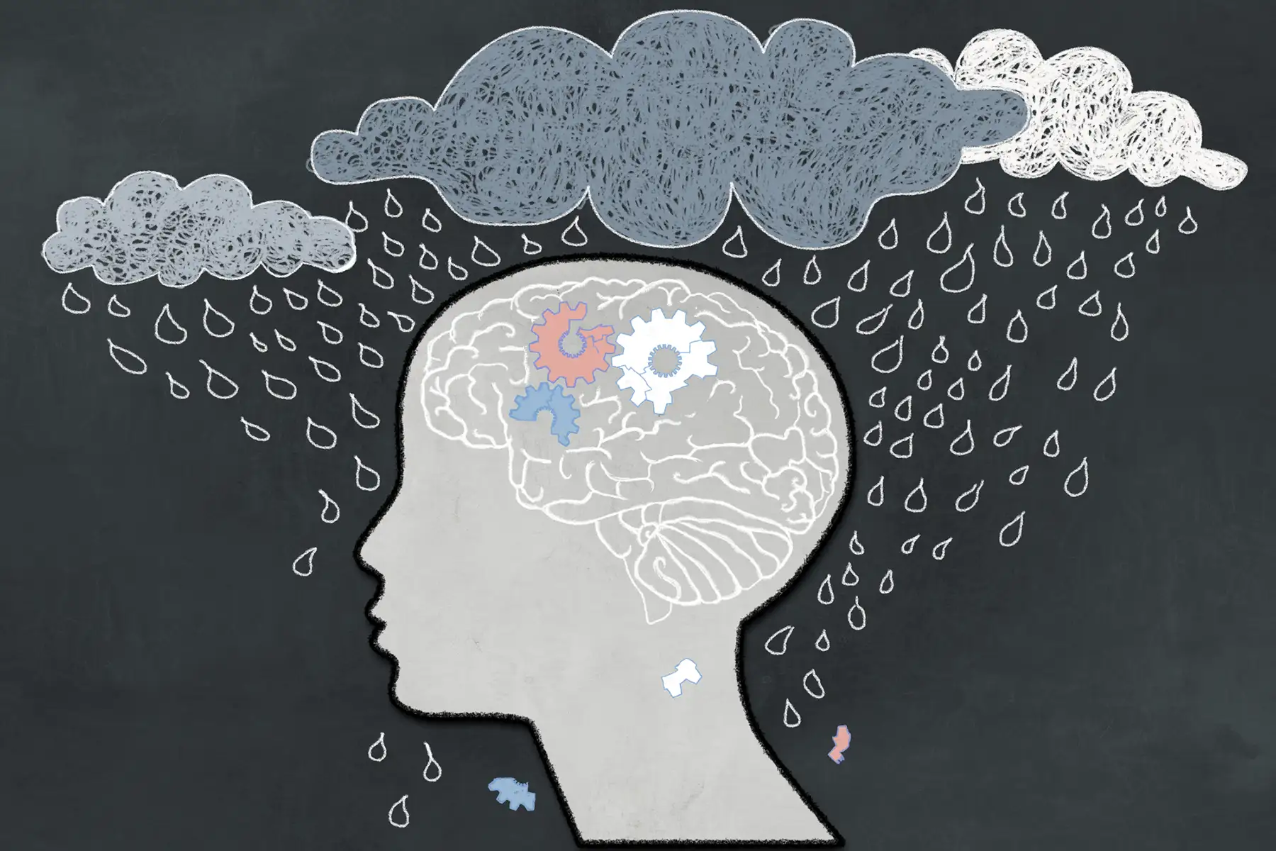 Major depressive disorder Image