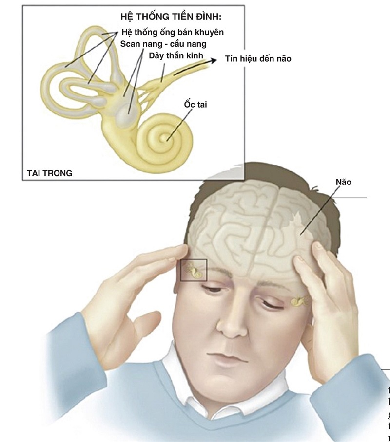 Auditory Vestibular and visual disorders of ischaemic aetiology Image