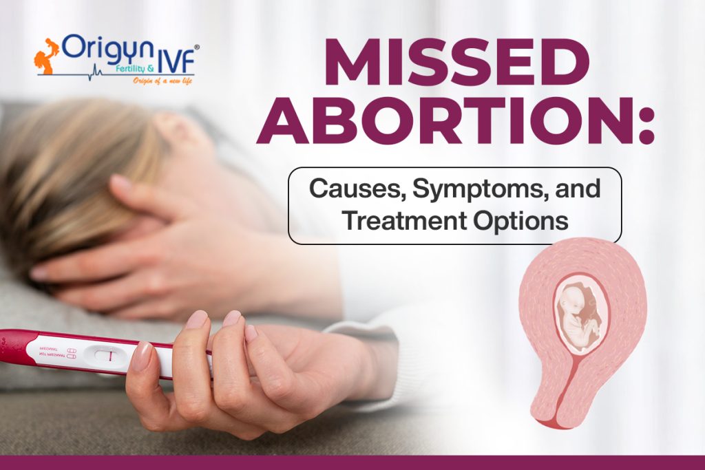 Missed abortion Image
