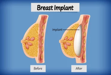 types of breast surgery for cancer in uae