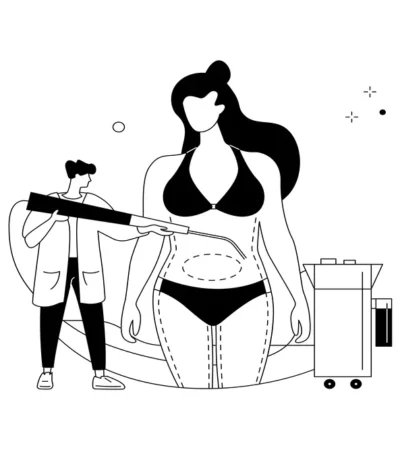 Abdominal Liposuction