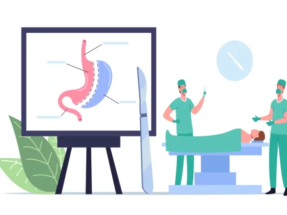 Trimming the Waistline: Unveiling Stomach Fat Removal